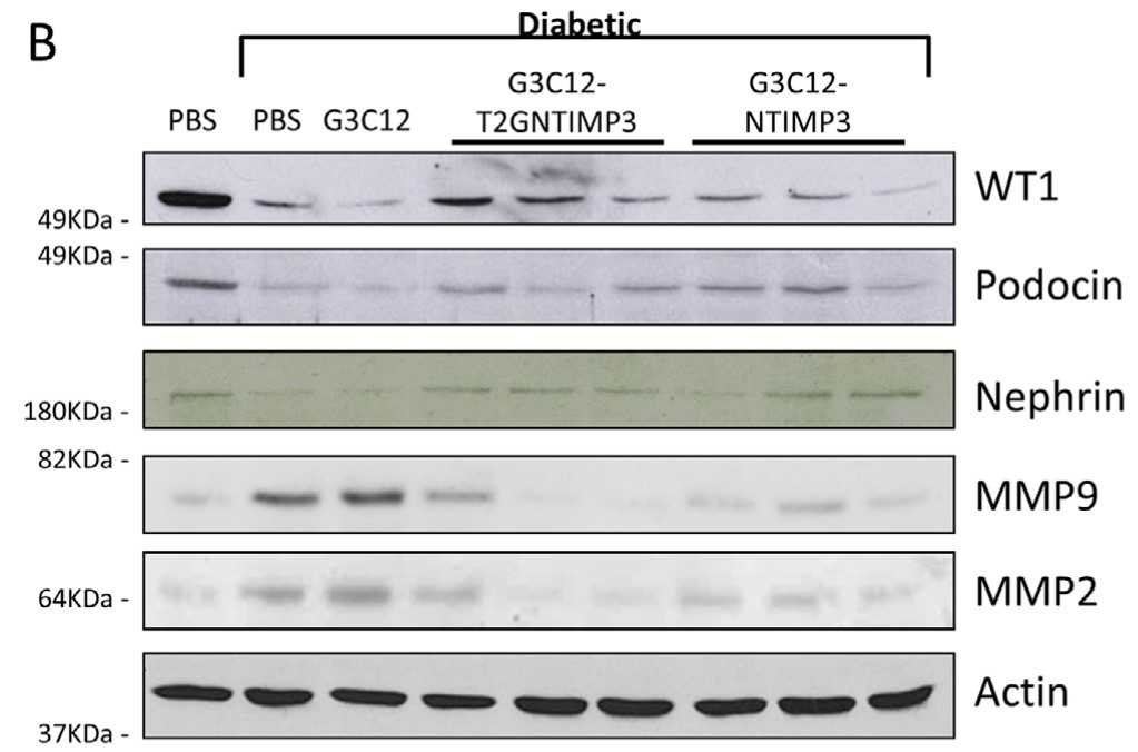 Protein expression in kidney cortex.jpg